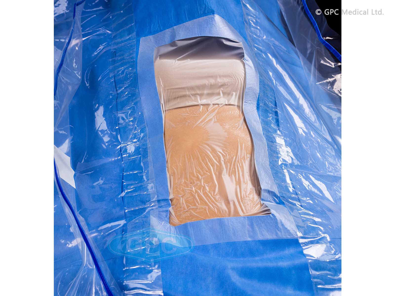 PAÑOS QUIRÚRGICOS PARA LA LAPAROTOMÍA